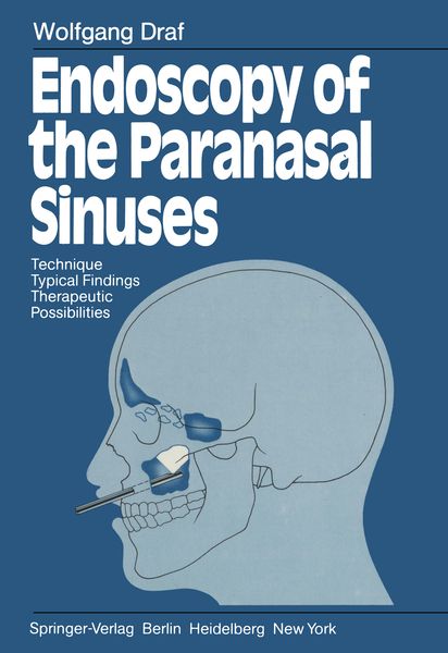 Produktbild: Endoscopy of the Paranasal Sinuses