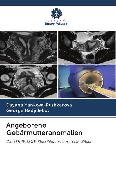 Angeborene Gebärmutteranomalien, Taschenbuch von Dayana Yankova-Pushkarova , George Hadjidekov, Sciencia Scripts, 9786202582728