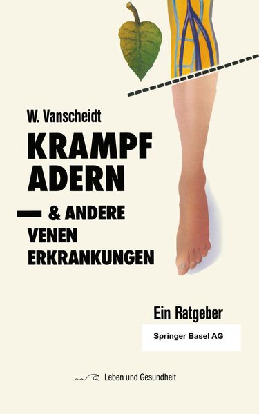 Produktbild: Krampfadern und andere Venenerkrankungen