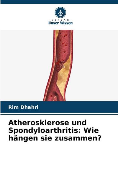 Produktbild: Atherosklerose und Spondyloarthritis: Wie h&auml;ngen sie zusammen?