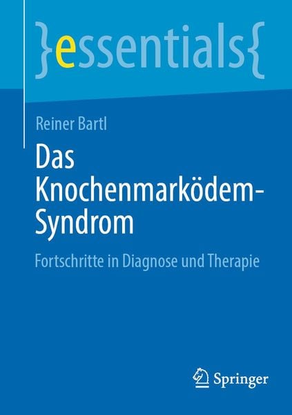 Produktbild: Das Knochenmark&ouml;dem-Syndrom