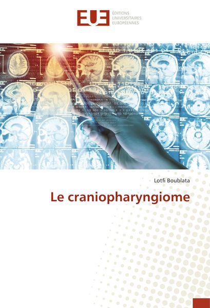 Produktbild: Le craniopharyngiome
