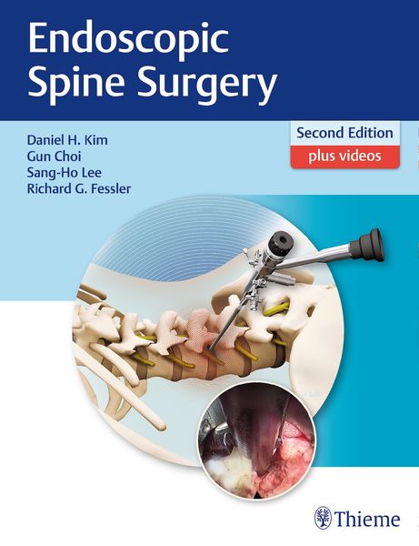 Produktbild: Endoscopic Spine Surgery