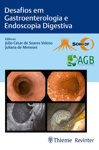 Produktbild: Desafios em Gastroenterologia e Endoscopia Digestiva