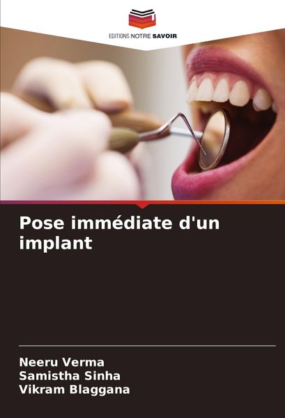 Produktbild: Pose imm&eacute;diate d'un implant