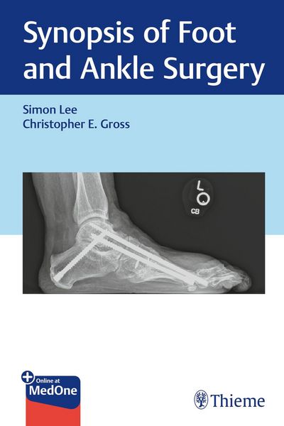 Produktbild: Synopsis of Foot and Ankle Surgery
