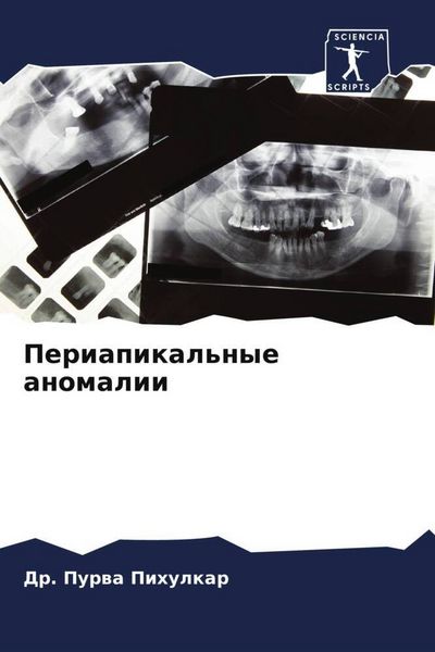 Produktbild: Periapikal'nye anomalii