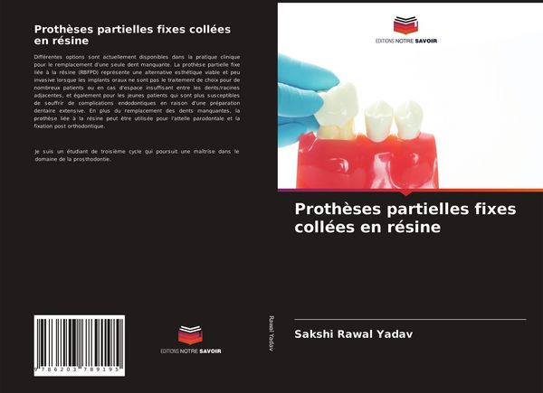 Produktbild: Proth&egrave;ses partielles fixes coll&eacute;es en r&eacute;sine
