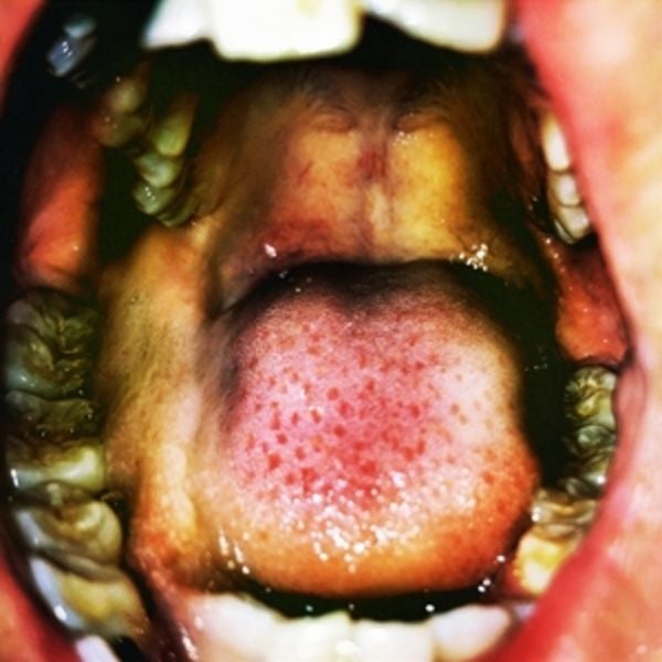 Public Storage - Hana Vu, Vinyl