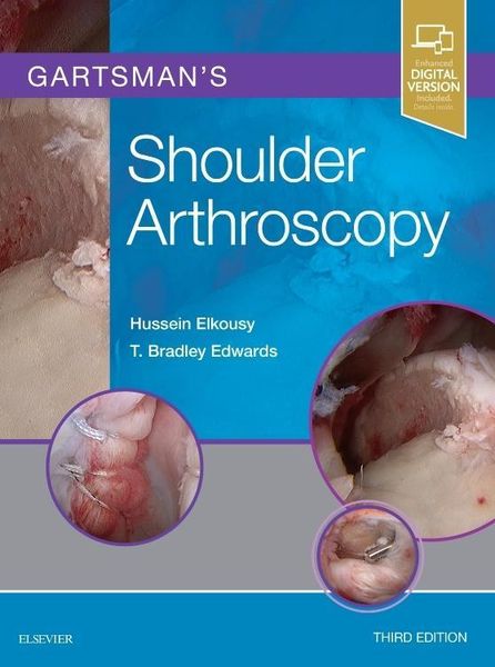 Produktbild: Gartsman's Shoulder Arthroscopy