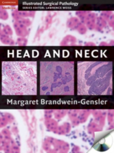 Produktbild: Head and Neck