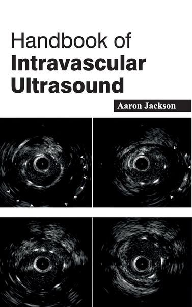 Produktbild: Handbook of Intravascular Ultrasound