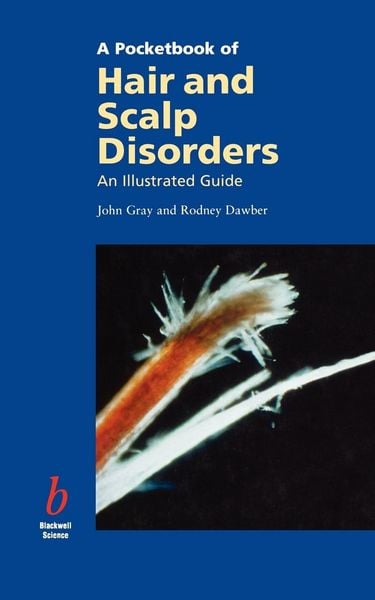 Produktbild: Pocketbook of Hair and Scalp Disorders
