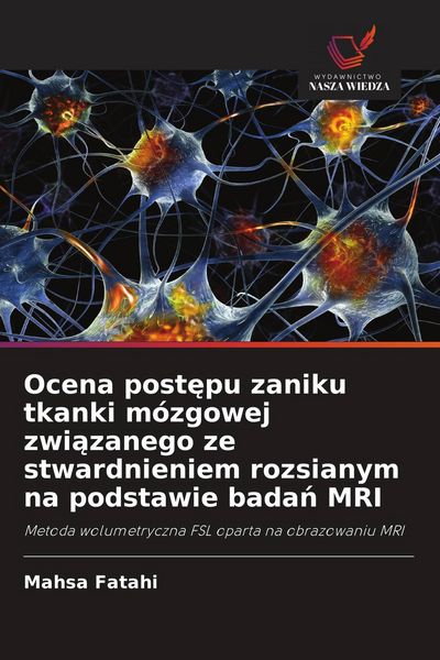 Produktbild: Ocena post&iquest;pu zaniku tkanki m&oacute;zgowej zwi&iquest;zanego ze stwardnieniem rozsianym na podstawie bada&iquest; MRI