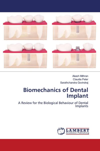 Produktbild: Biomechanics of Dental Implant