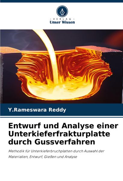 Entwurf und Analyse einer Unterkieferfrakturplatte durch Gussverfahren, Taschenbuch von Y. Rameswara Reddy, Verlag Unser Wissen, 9786208336295