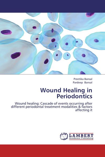 Produktbild: Wound Healing in Periodontics