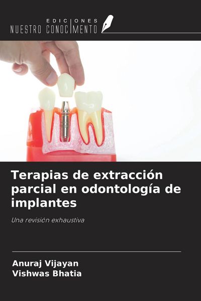 Produktbild: Terapias de extracci&oacute;n parcial en odontolog&iacute;a de implantes