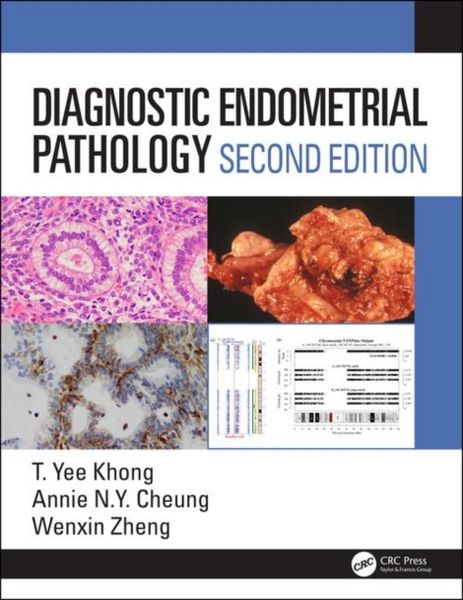 Produktbild: Diagnostic Endometrial Pathology 2e