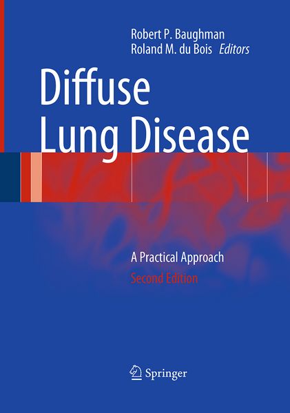 Produktbild: Diffuse Lung Disease