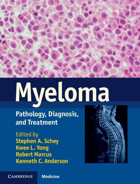 Produktbild: Myeloma