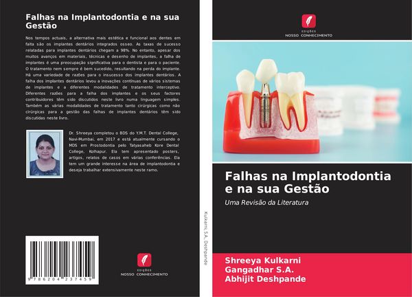Produktbild: Falhas na Implantodontia e na sua Gest&atilde;o