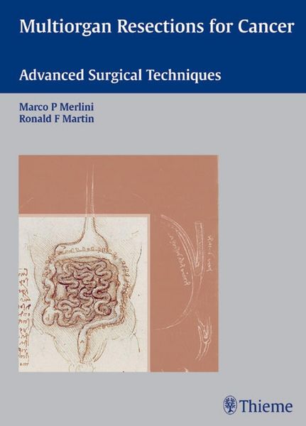 Produktbild: Multiorgan Resections for Cancer