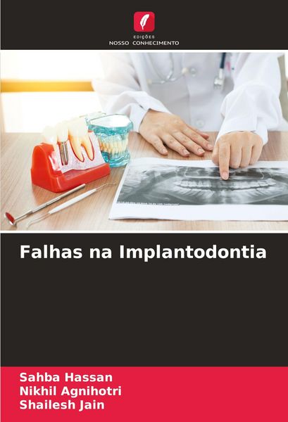 Produktbild: Falhas na Implantodontia