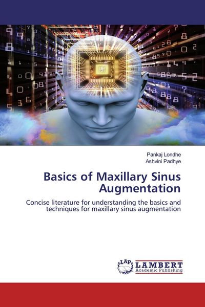 Produktbild: Basics of Maxillary Sinus Augmentation