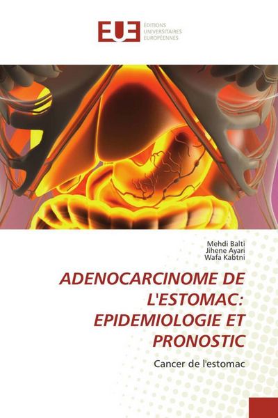 Produktbild: Adenocarcinome De L'estomac: Epidemiologie Et Pronostic
