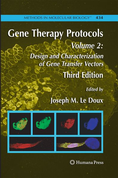 Produktbild: Gene Therapy Protocols