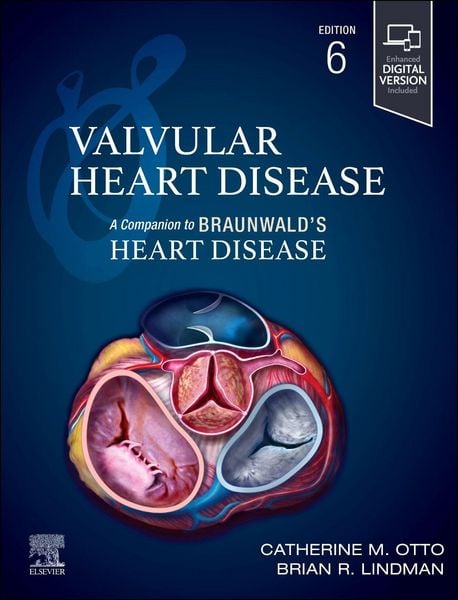 Produktbild: Valvular Heart Disease: A Companion to Braunwald's Heart Disease