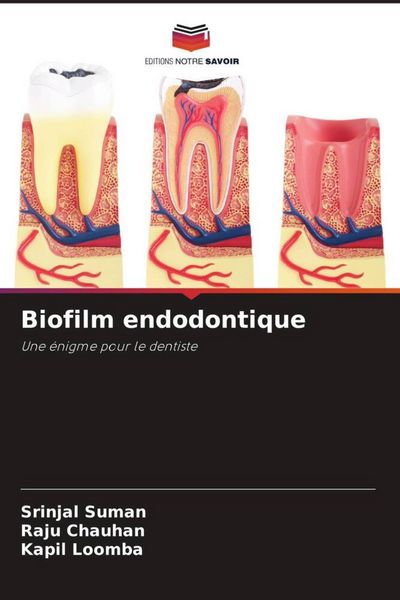 Produktbild: Biofilm endodontique