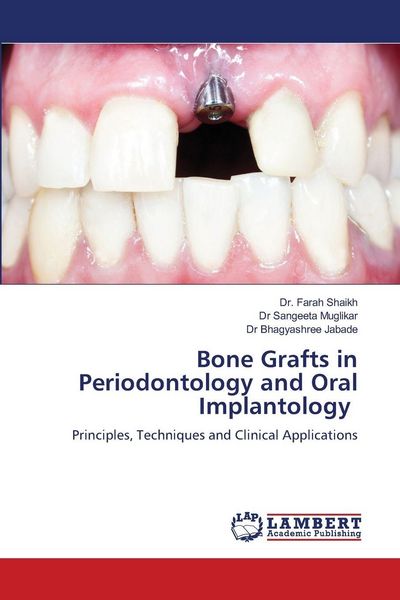 Produktbild: Bone Grafts in Periodontology and Oral Implantology