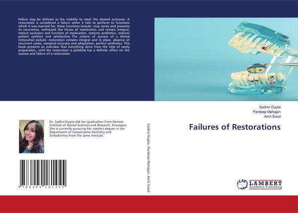 Produktbild: Failures of Restorations