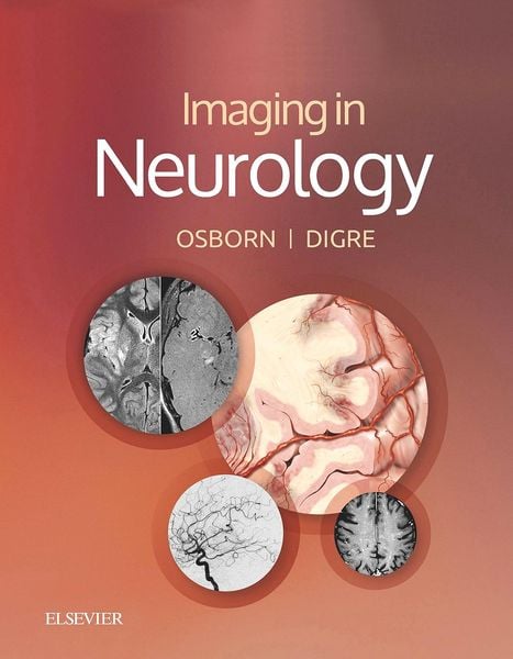 Produktbild: Imaging in Neurology E-Book