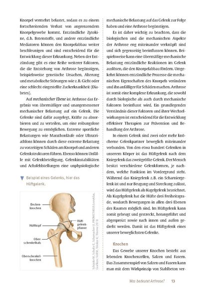 Produktbild: Arthrose