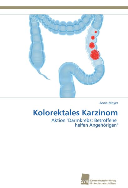 Produktbild: Kolorektales Karzinom