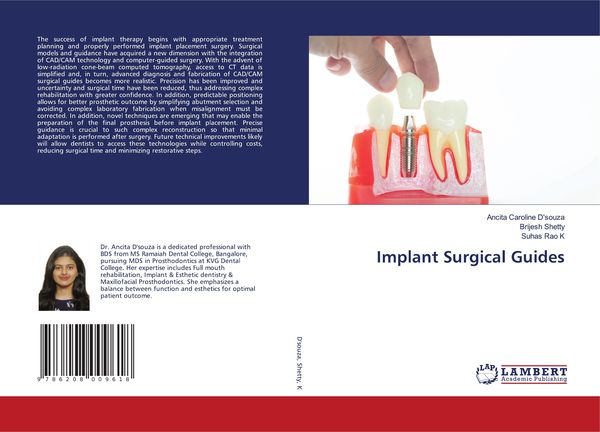 Produktbild: Implant Surgical Guides
