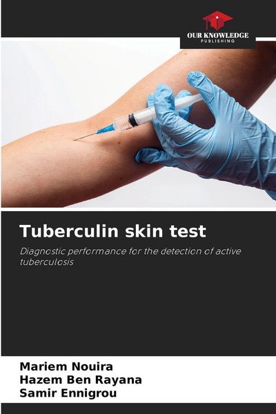 Produktbild: Tuberculin skin test
