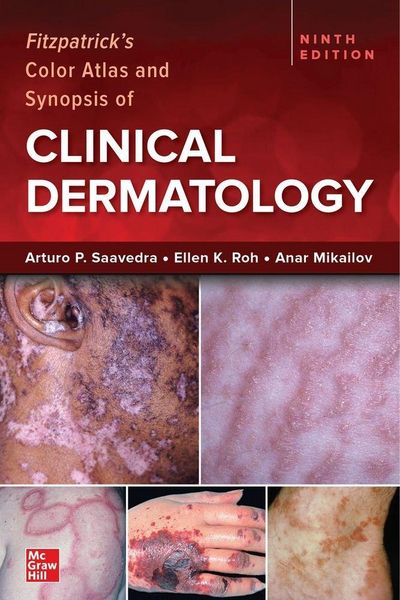 Produktbild: Fitzpatrick's Color Atlas and Synopsis of Clinical Dermatology, Ninth Edition