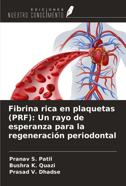 Produktbild: Fibrina rica en plaquetas (PRF): Un rayo de esperanza para la regeneraci&oacute;n periodontal