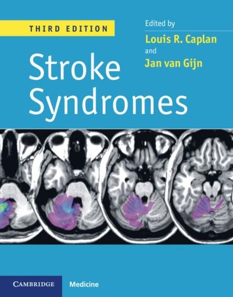 Produktbild: Stroke Syndromes, 3ed