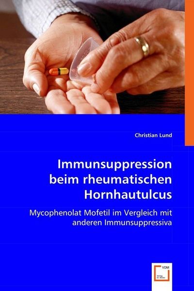 Produktbild: Lund, C: Immunsuppression beim rheumatischen Hornhautulcus