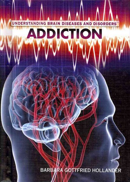 Produktbild: Understanding Brain Diseases and Disorders