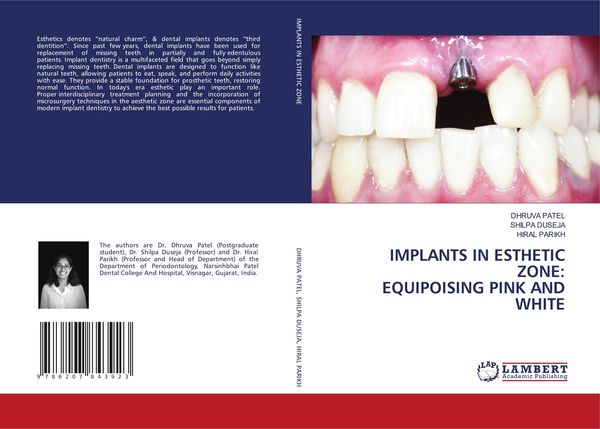 Produktbild: Implants in Esthetic Zone: Equipoising Pink and White