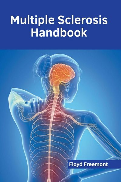 Produktbild: Multiple Sclerosis Handbook
