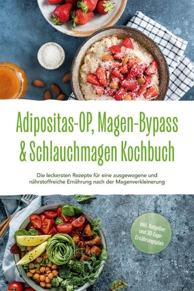 Produktbild: Adipositas-OP, Magen-Bypass & Schlauchmagen Kochbuch: Die leckersten Rezepte f&uuml;r eine ausgewogene und n&auml;hrstoffreiche Ern&auml;hrung nach der Magenverklein