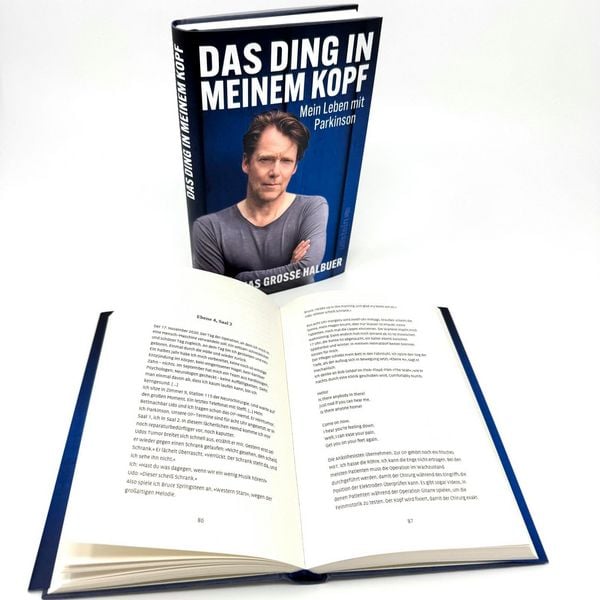 Produktbild: Das Ding in meinem Kopf