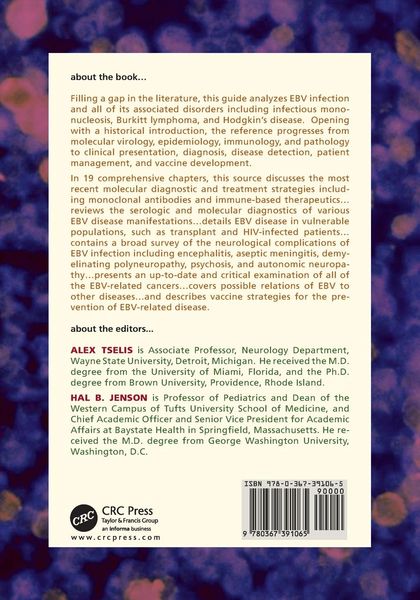 Produktbild: Epstein-Barr Virus
